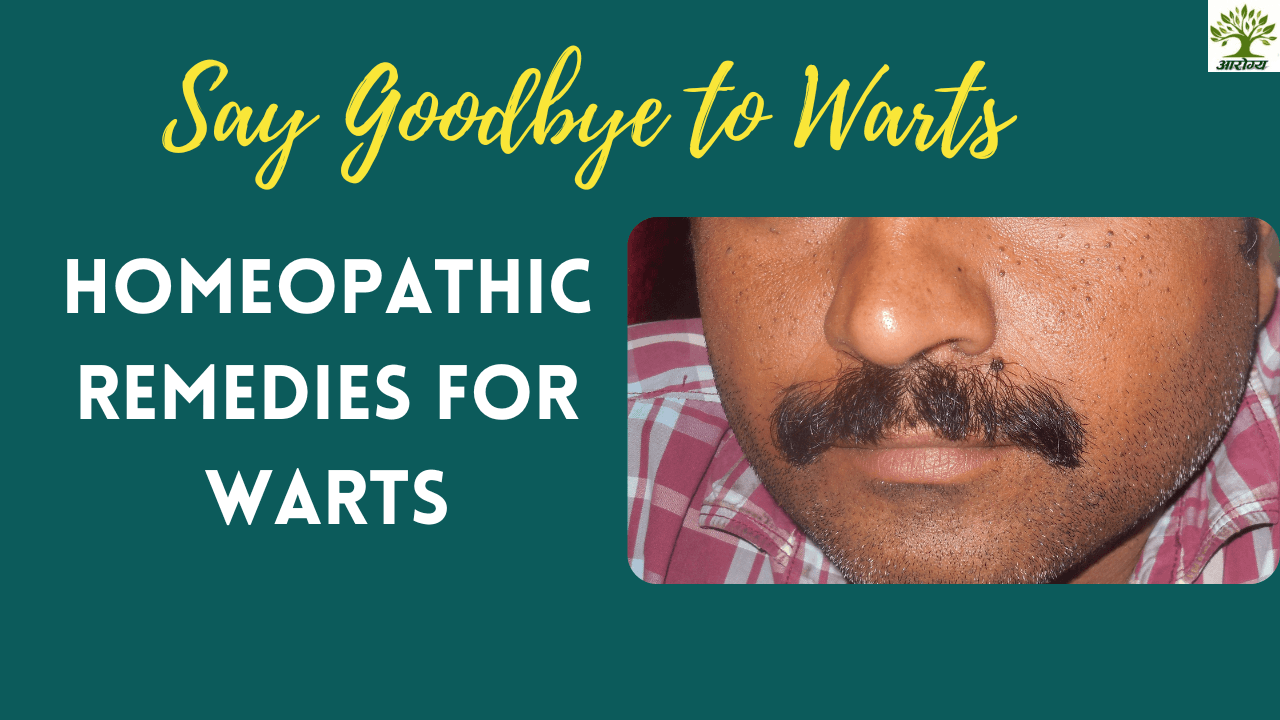 Natural treatment for hpv warts